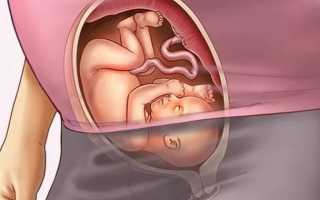 Икота при беременности на ранних сроках
