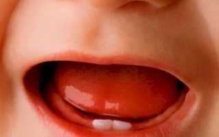 Понос при прорезывании зубов у детей